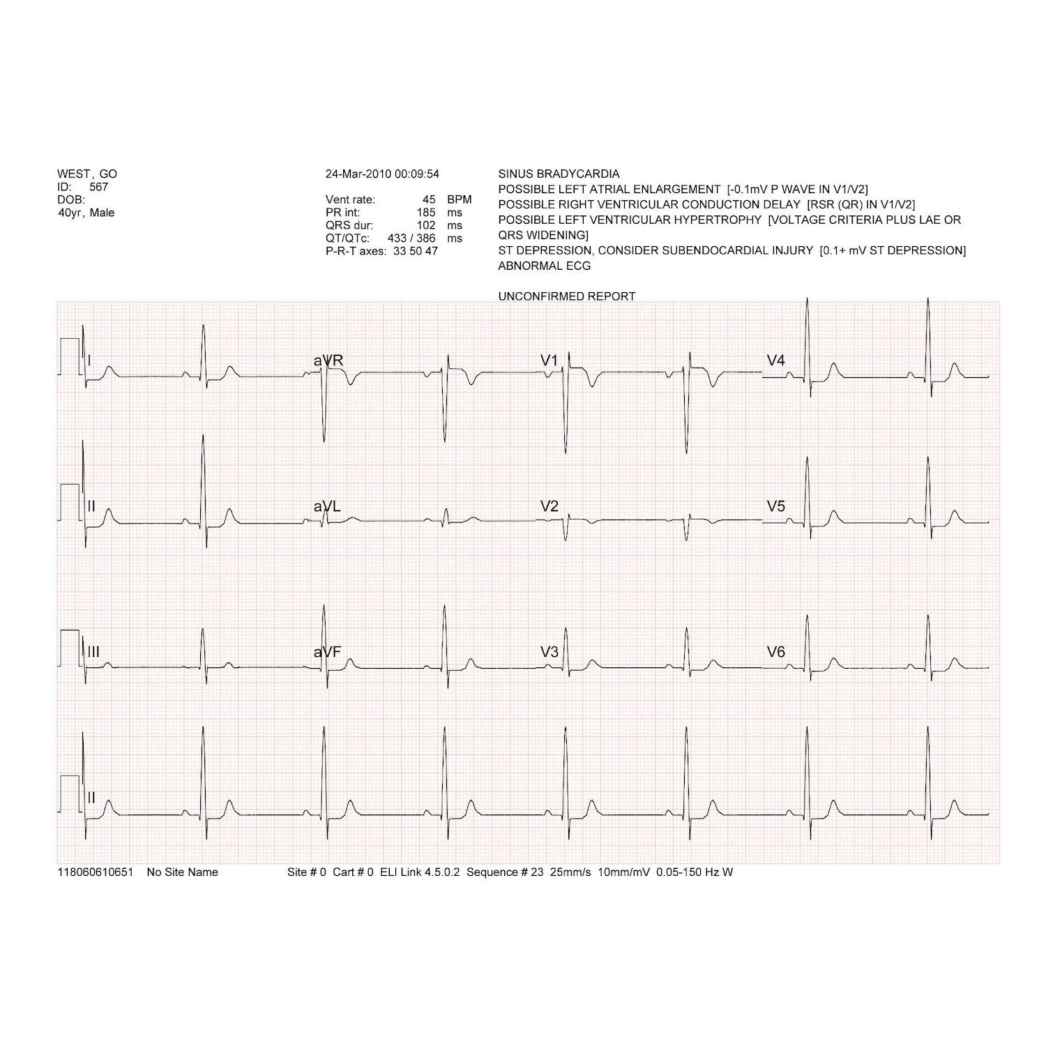 Welch Allyn/Mortara Eli150c ECG with wireless patient cable (1)
