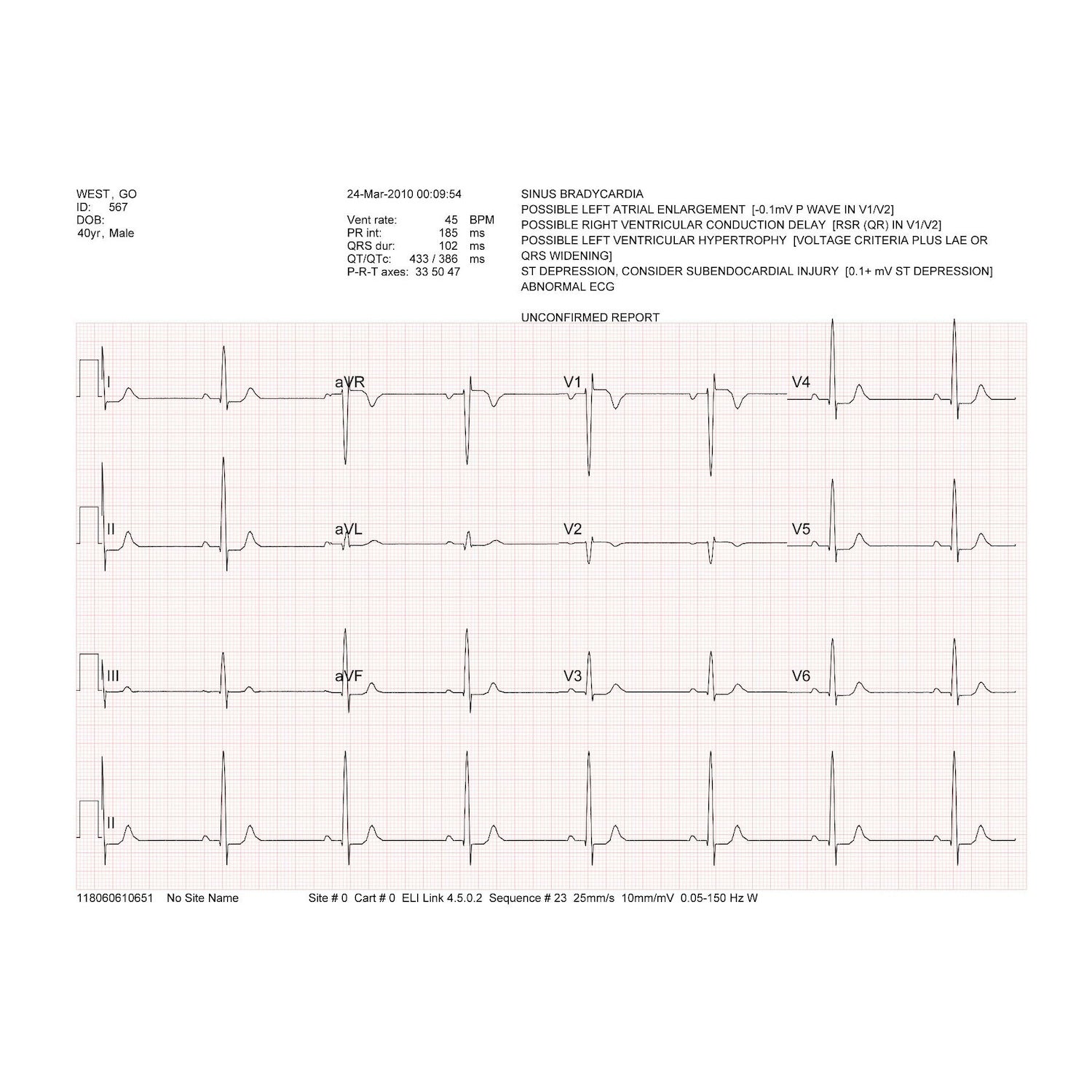 Welch Allyn/Mortara ELI230 ECG with wireless patient cable (1)
