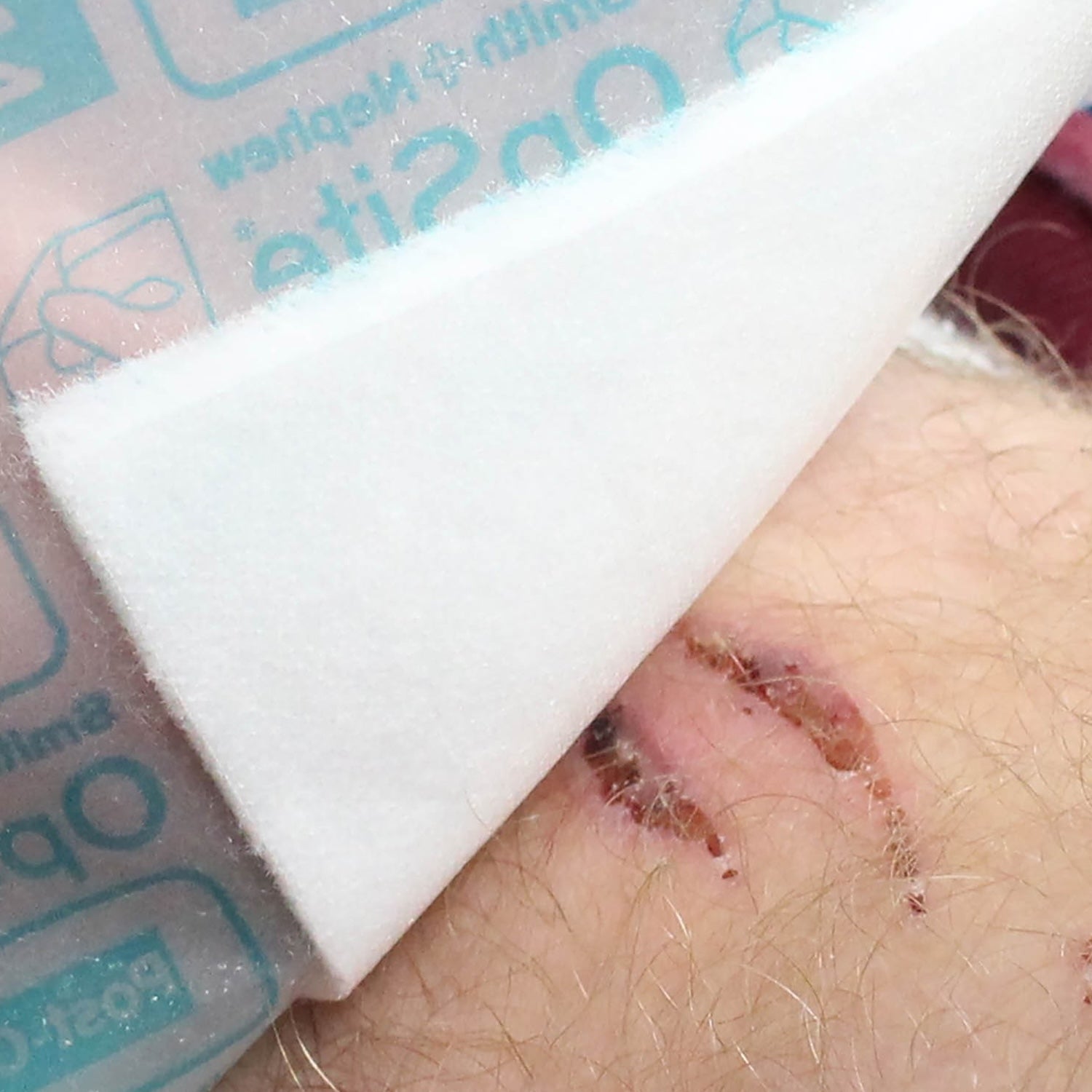 Opsite Post Op Visible | 25 x 10cm (6)