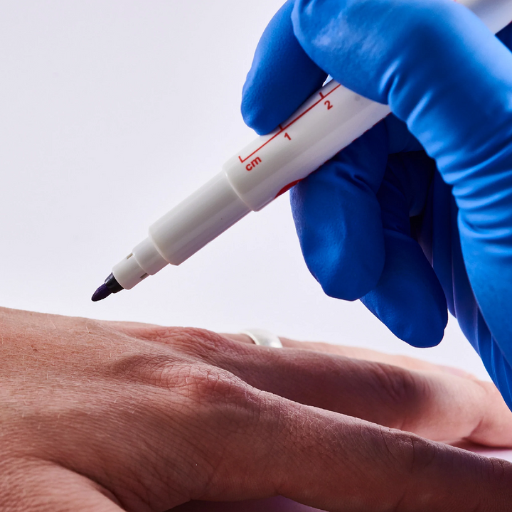 Image of Viomedex Surgical Skin Marker Pen
