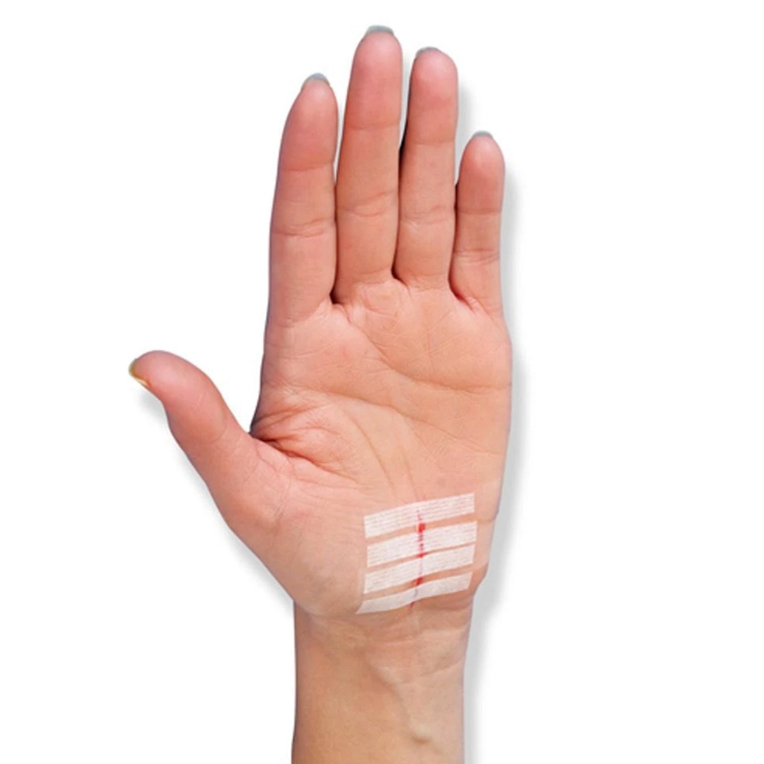 Leukostrip Skin Closure Strips | 4 x 38mm | 8 Strips | Pack of 50 (3)