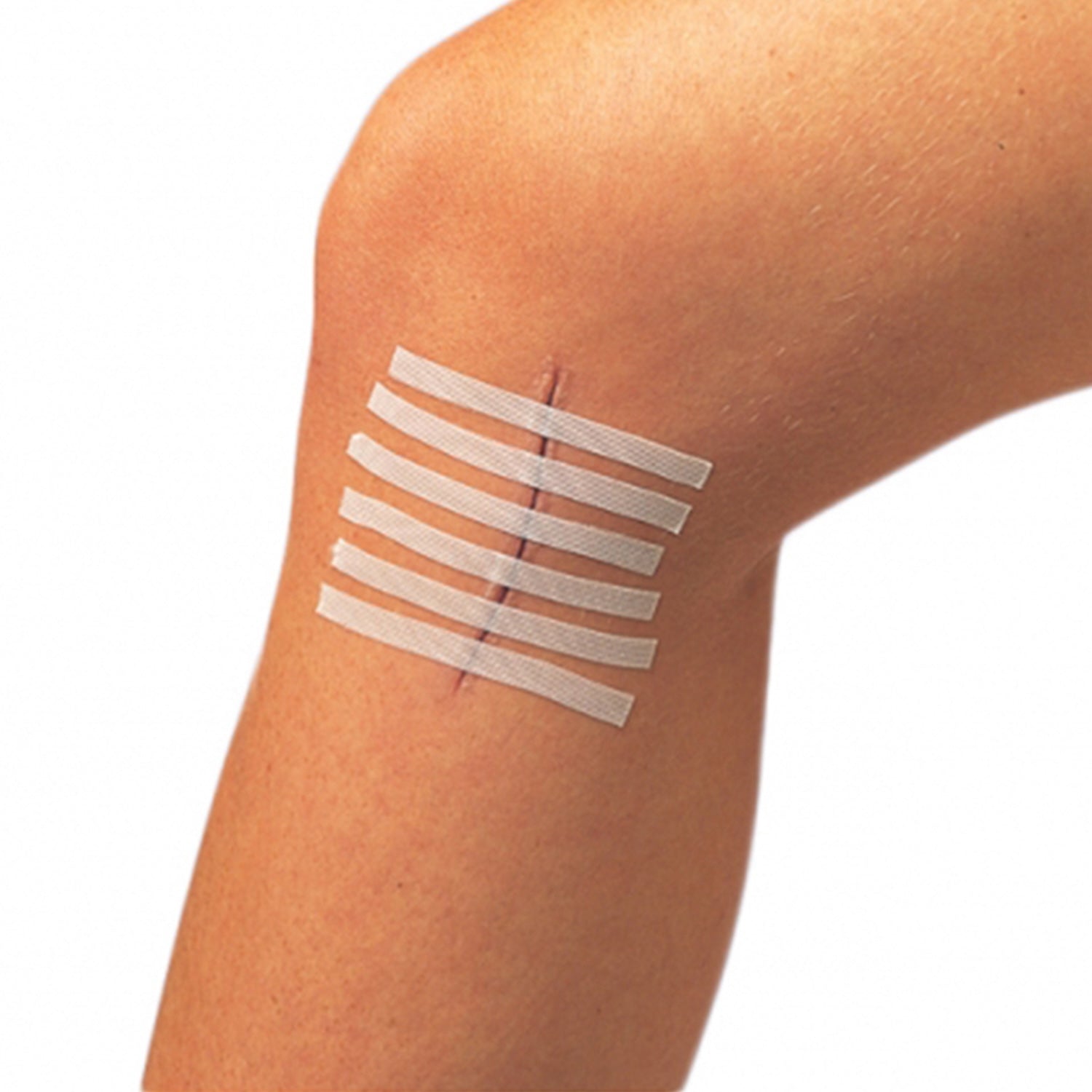 Leukostrip Skin Closure Strips | 4 x 38mm | 8 Strips | Pack of 50 (4)