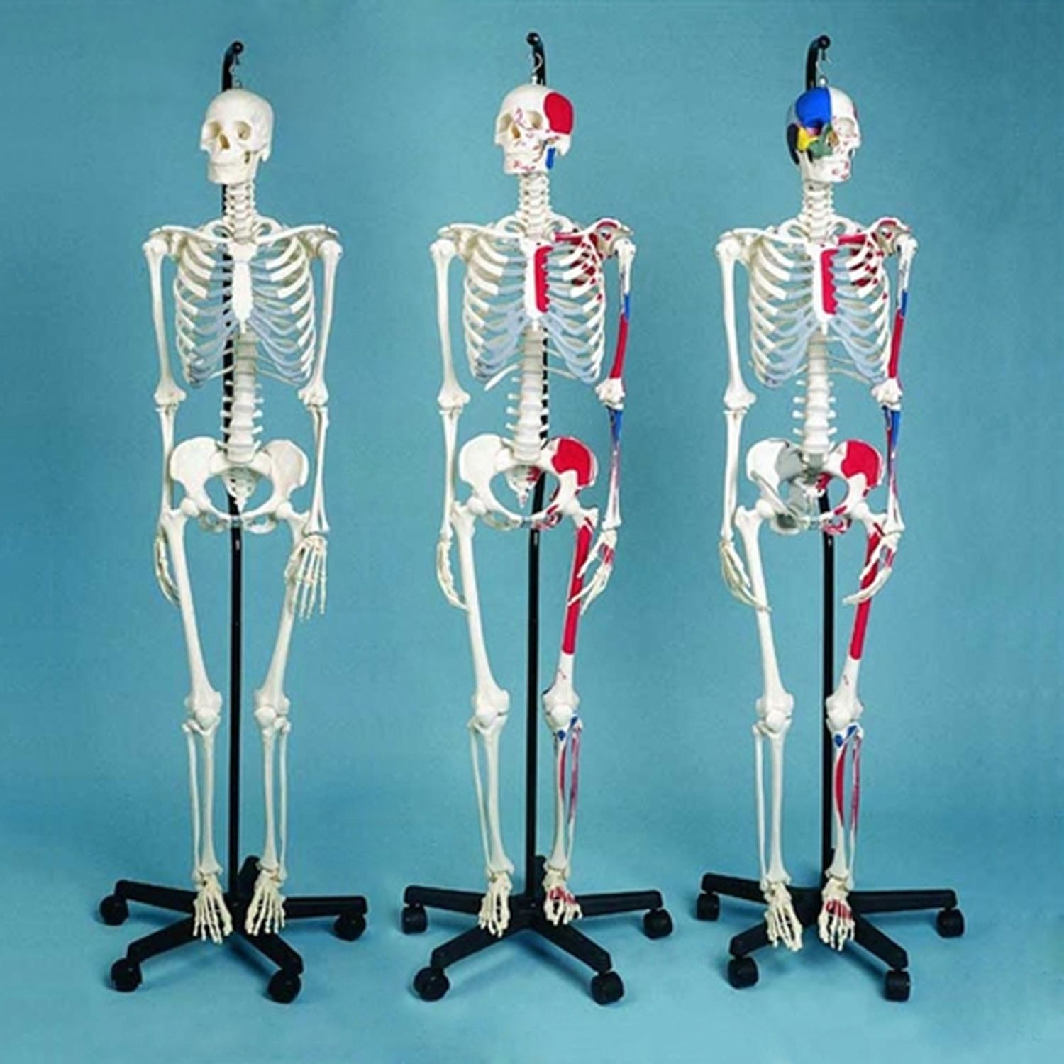 Female Skeleton Showing Muscular Attachments And Ligaments, Medical Quality